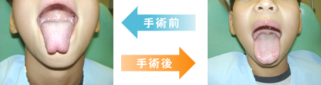 小児歯科